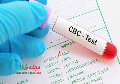 آزمایش cbc چه بیماریهایی را نشان میدهد