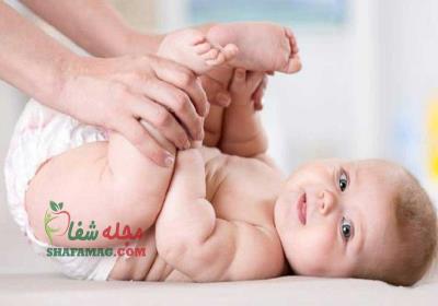 ادرار سوختگی نوزاد چیست و چگونه درمان می شود.