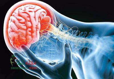 علائم سکته مغزی چیست