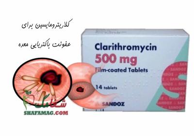 قرص کلاریترومایسین برای عفونت معده