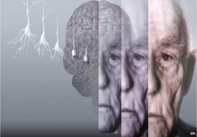 چه مواردی باعث پیر شدن مغز می شود